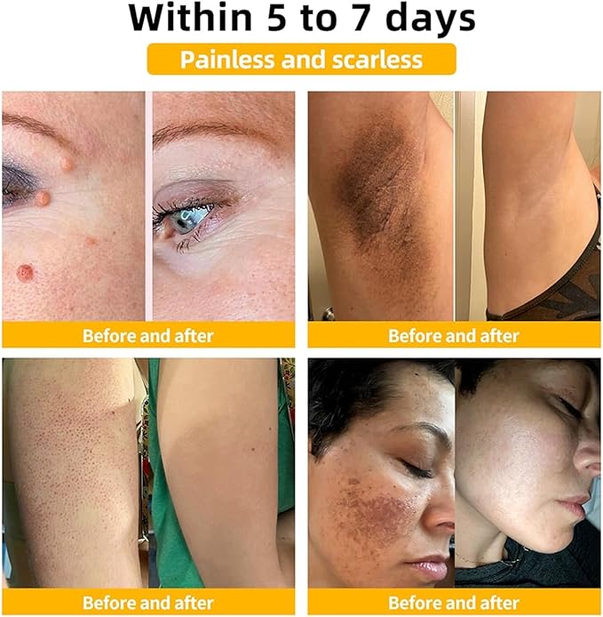 Bruise Repair & Skin-Strengthening Cream