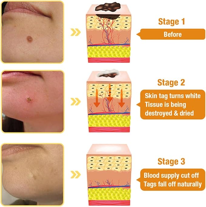 Bruise Repair & Skin-Strengthening Cream